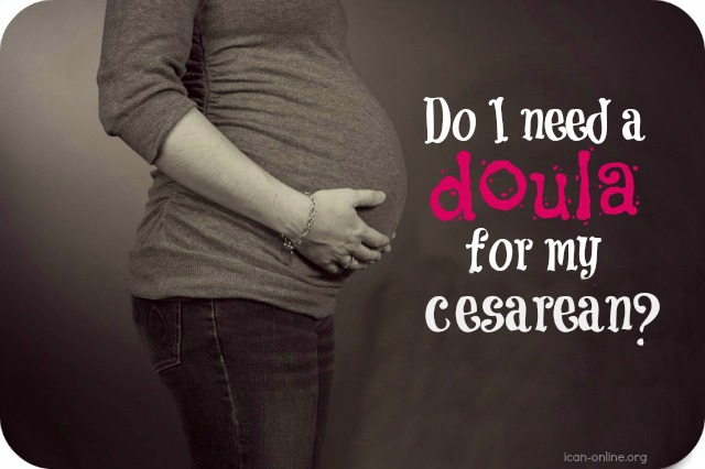 doula for cesarean